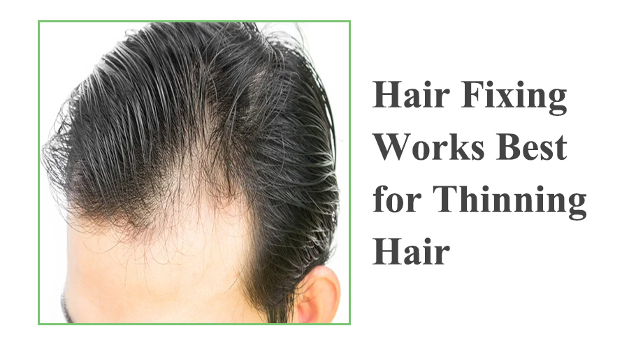 Hair Fixing Works Best for Thinning Hair